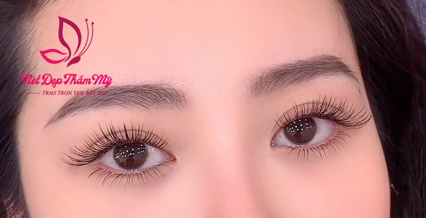 bầu nối mi