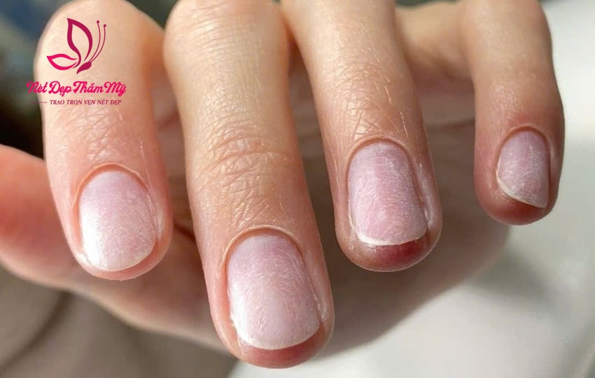 cách làm sạch móng tay