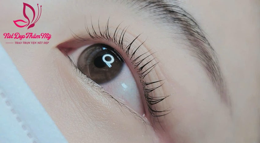 cắt mi có mọc không