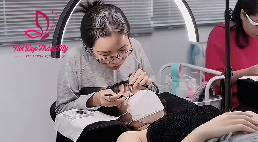 có bầu nối mi