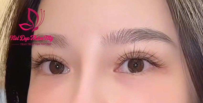 có nên nối mi khi đang có bầu
