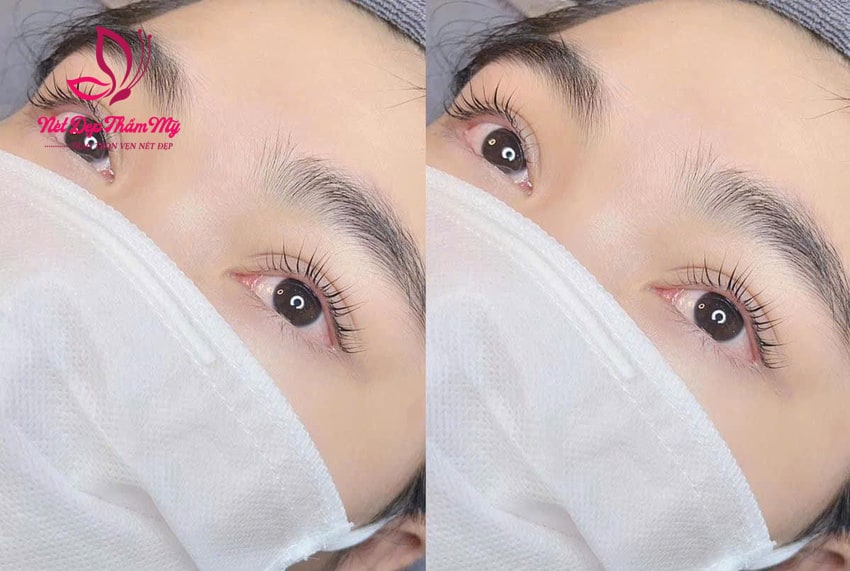 lông mi có mọc lại được không