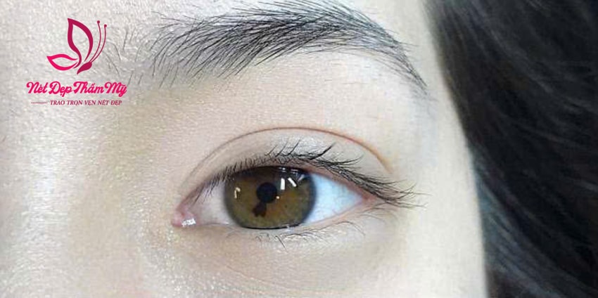 lông mi rụng có mọc lại không