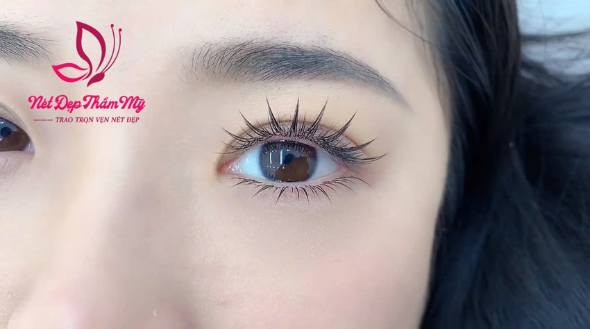 mắt ướt là gì