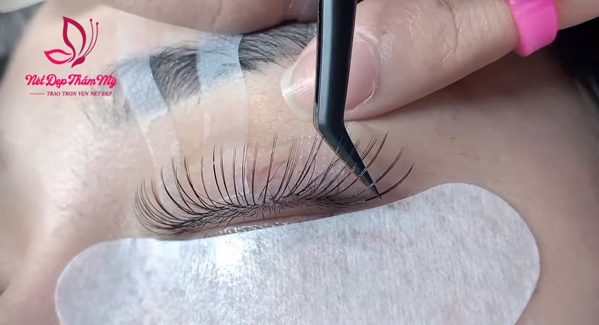 mi mắt mèo là gì