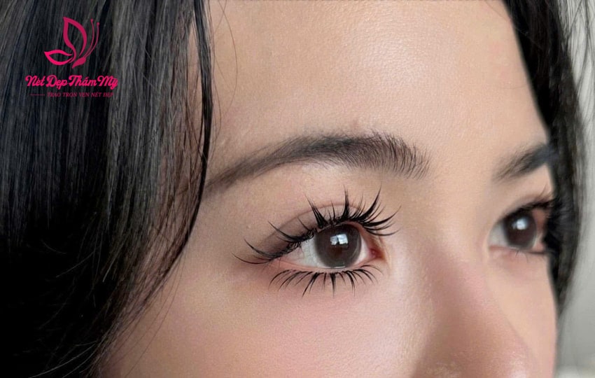 ngứa mi mắt khi nối mi