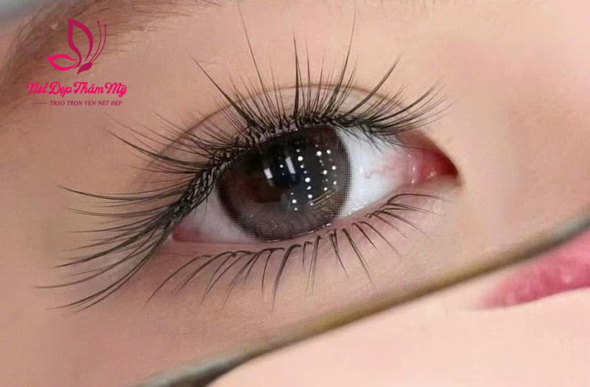 nối mi
