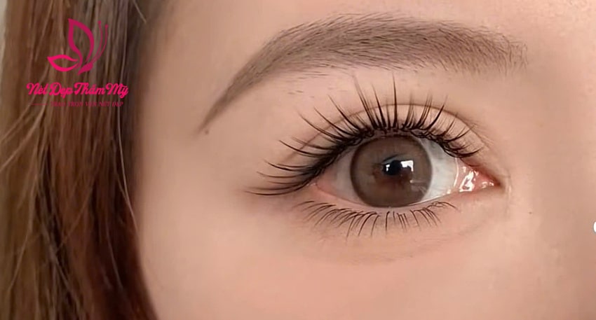 nối mị bị ngứa mí mắt