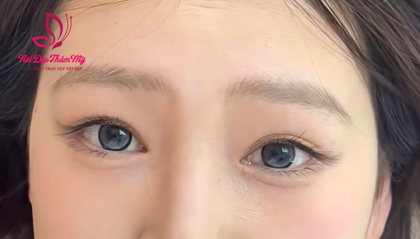 nối mi cho mắt một mí