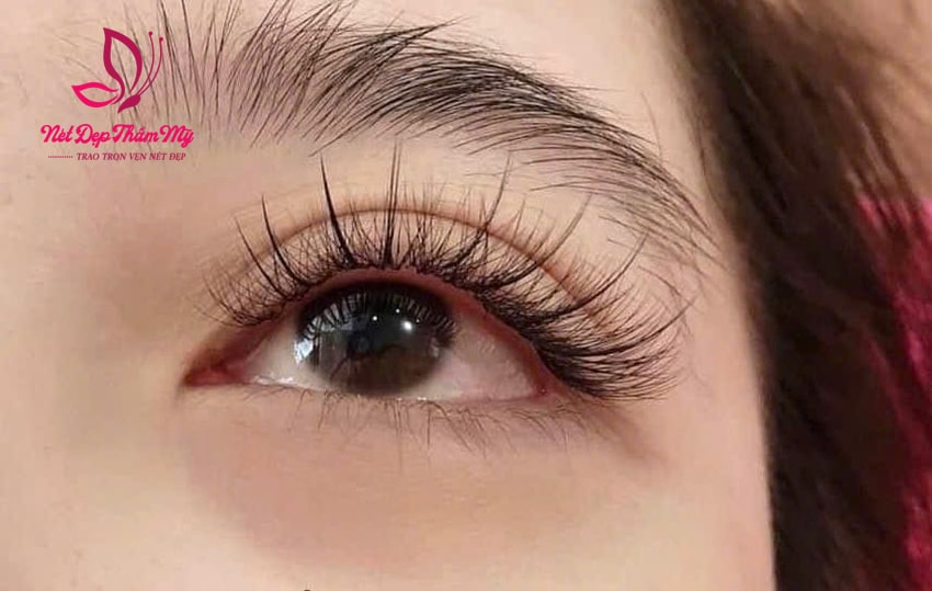 địa chỉ nối mi quận gò vấp