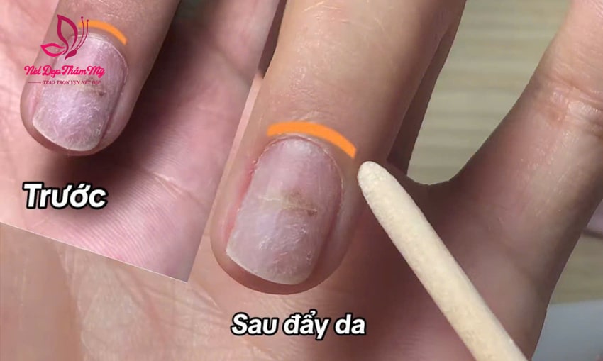 miếng dán móng tay